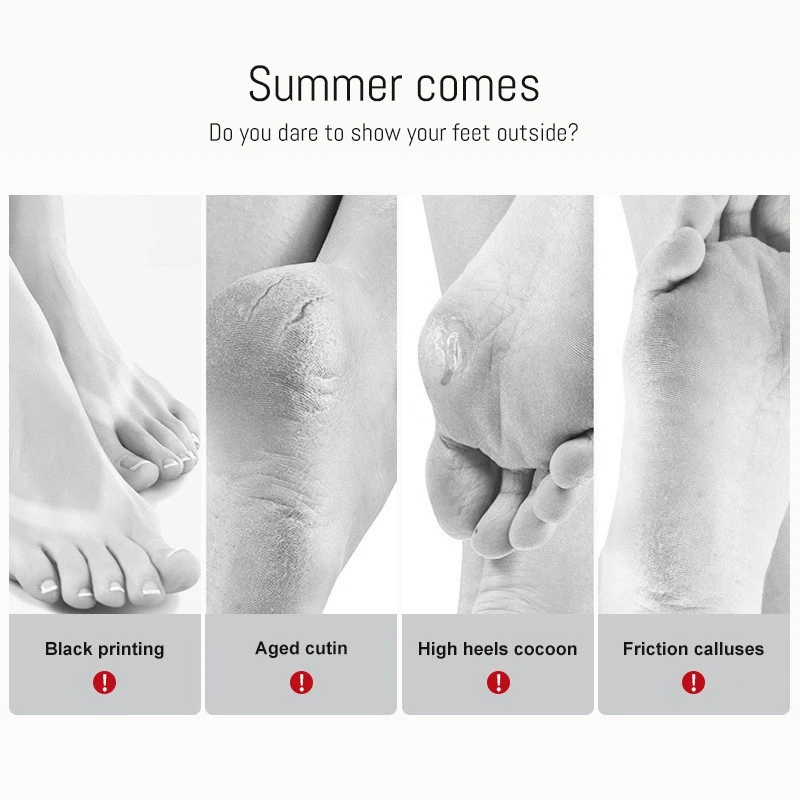 Foot Mask That Peels Skin factory Foot Mask That Peels Skin factory